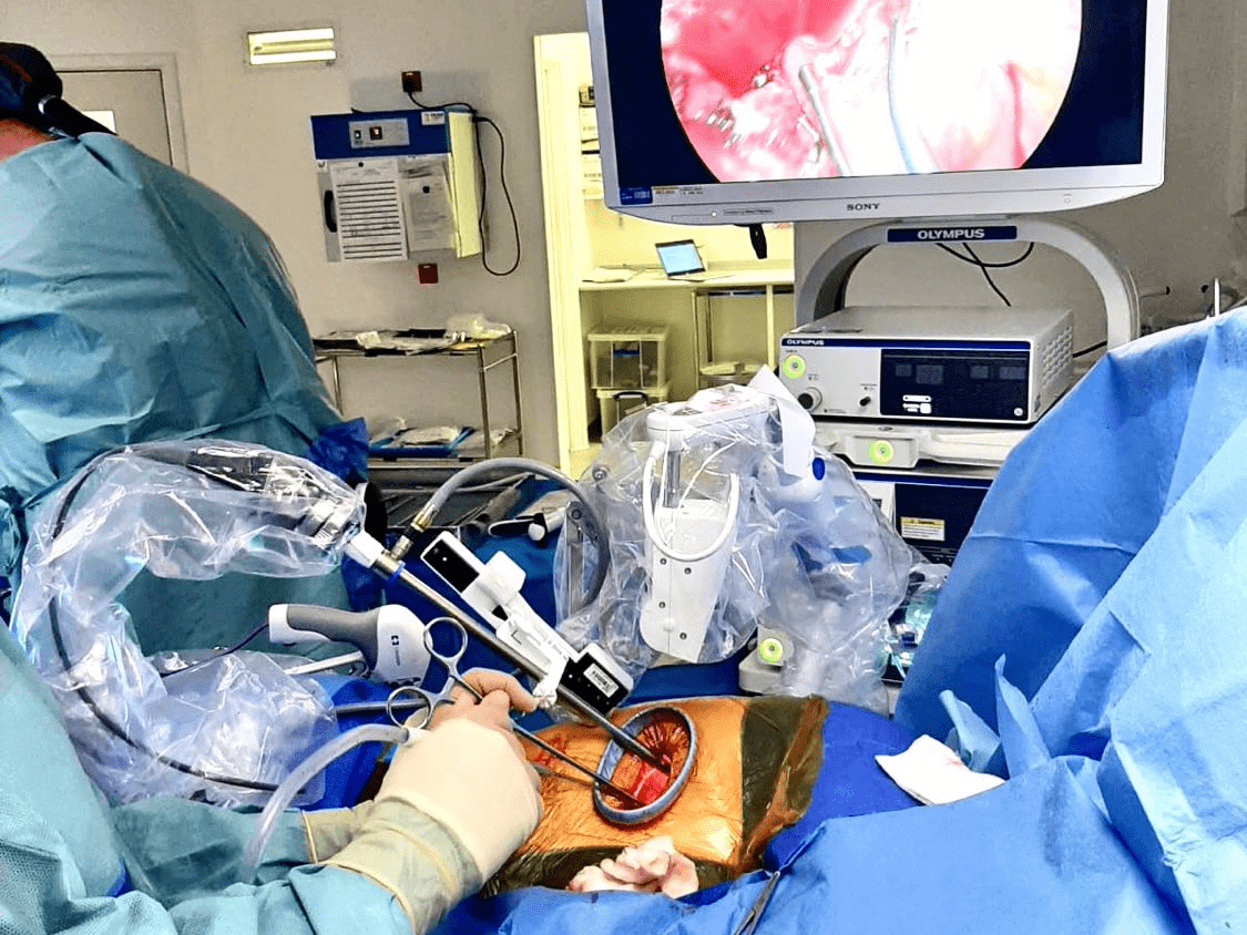 Aman Coonar performing a robot assisted VATS Lobectomy with Freehand Panorama