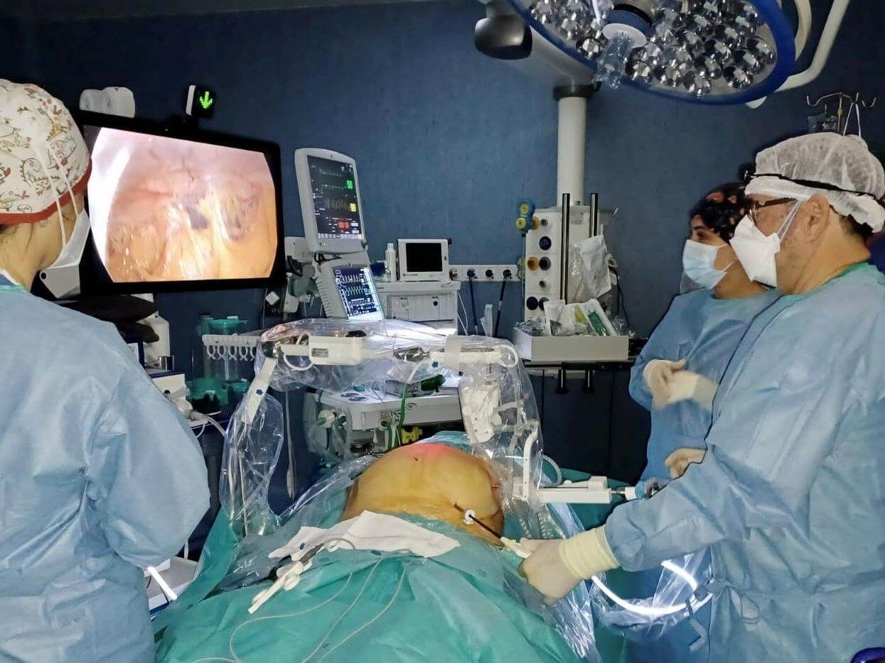 Surgeon and surgical team performing surgery with a robotic camera