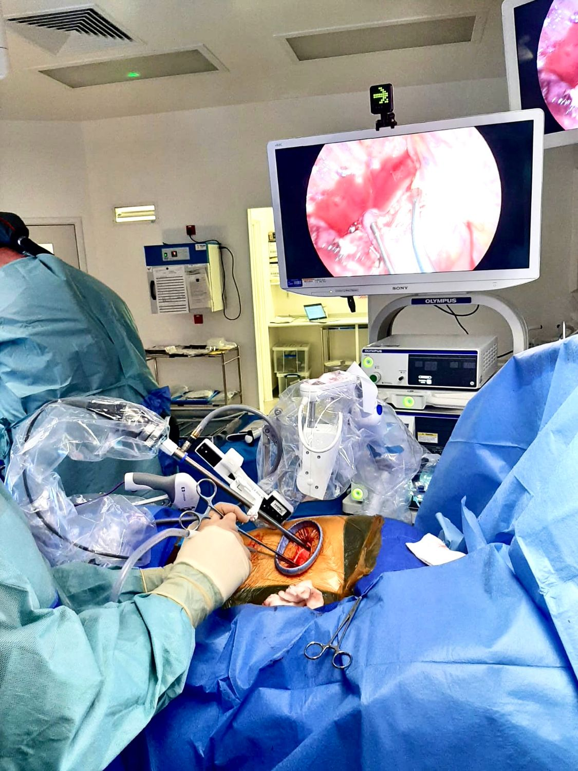 Aman Coonar performing a robot assisted VATS Lobectomy with Freehand Panorama