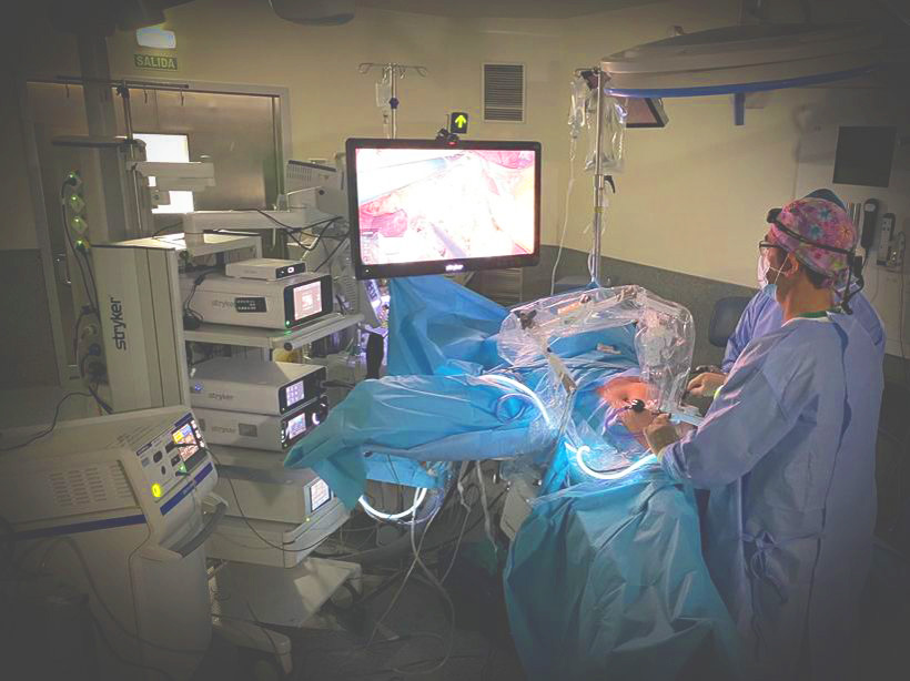 Solo surgeon with robotic assistant performing a cholecystectomy