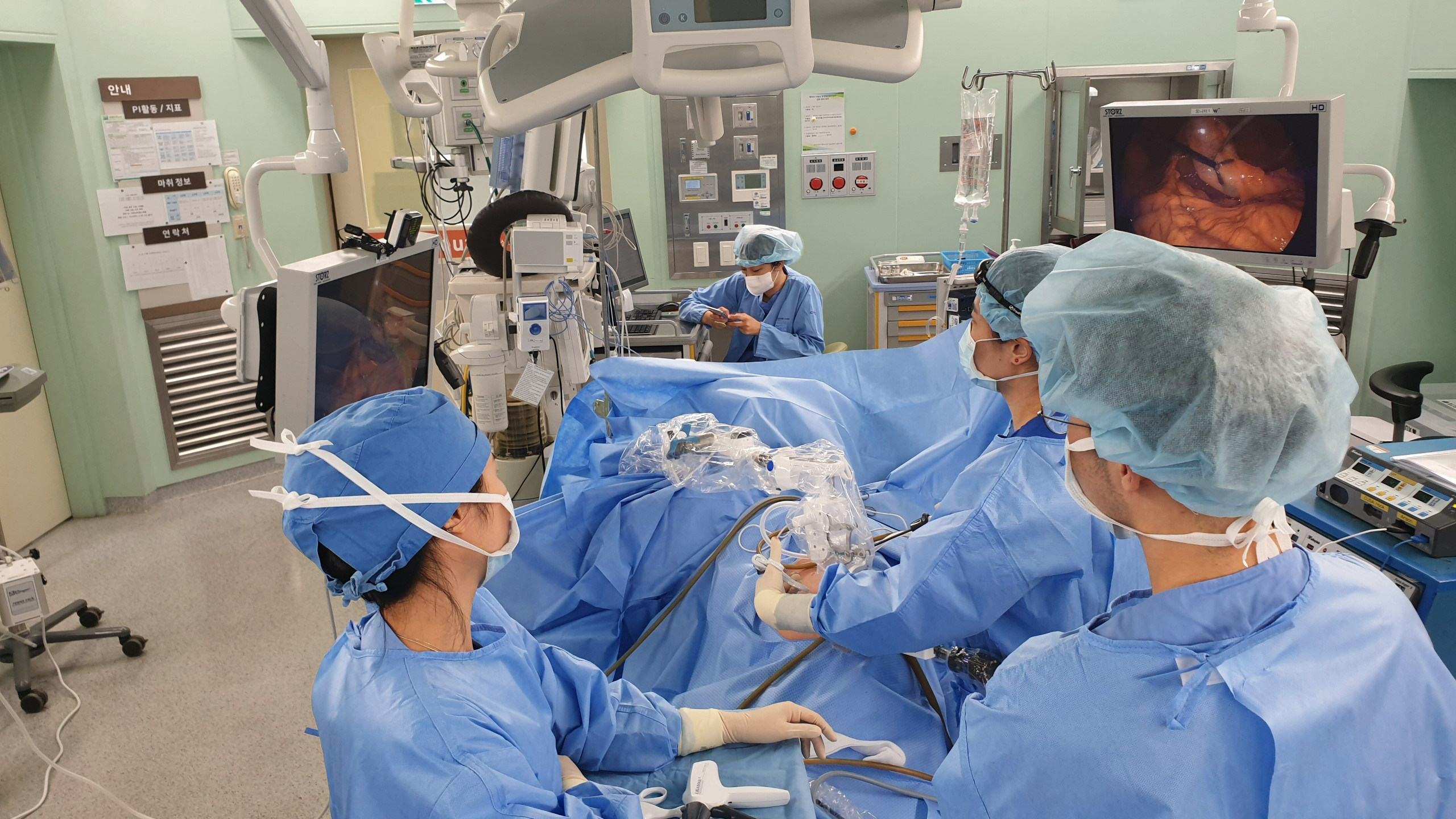 panorama surgical robot assisting laparoscopic cholecystectomy